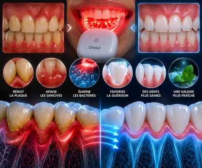 GumRevive Red Light Therapy System Kit